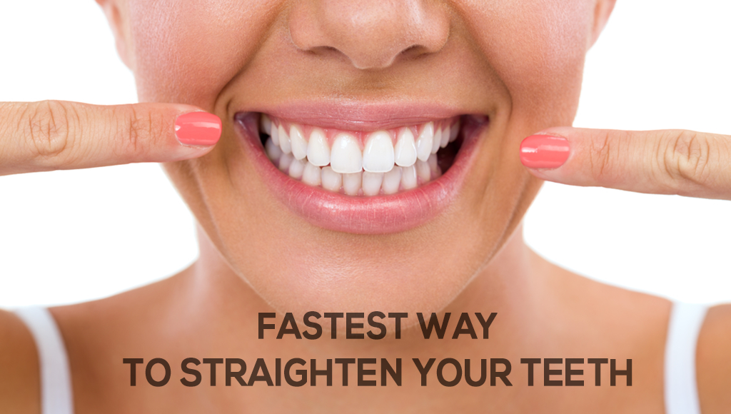 What S The Fastest Way To Straighten Your Teeth